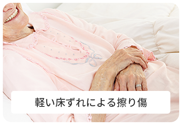 軽い床ずれによる擦り傷