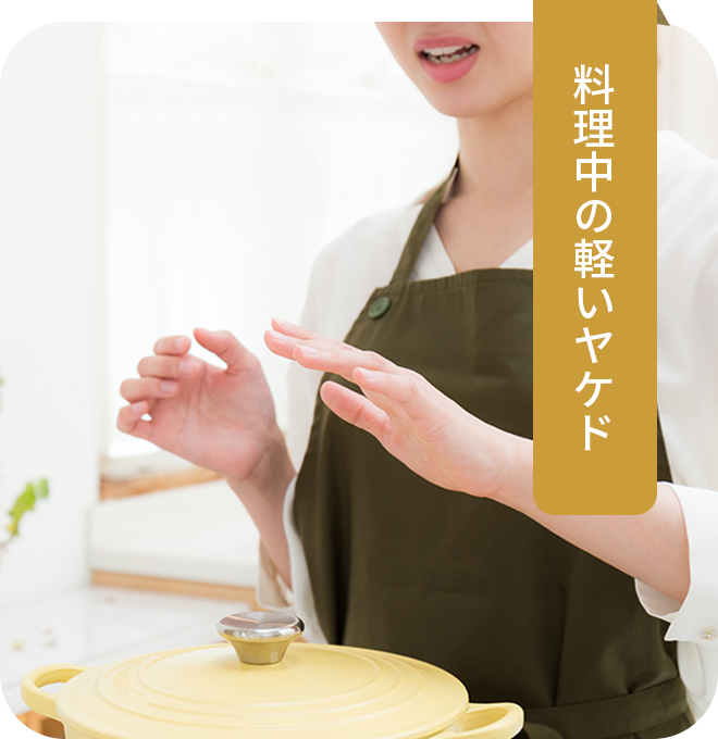料理中の軽いヤケド