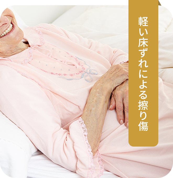 軽い床ずれによる擦り傷