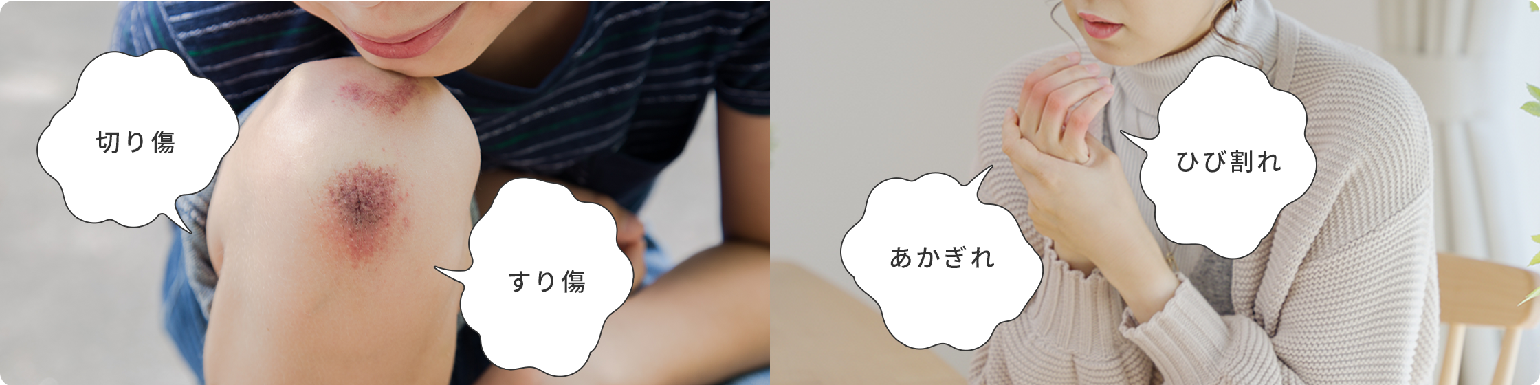 切り傷 すり傷 あかぎれ ひび割れ