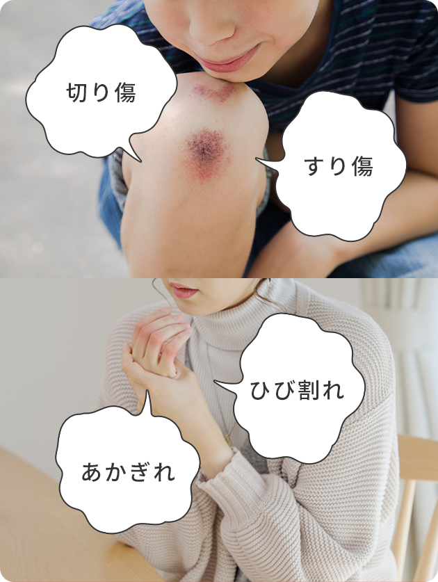 切り傷 すり傷 あかぎれ ひび割れ